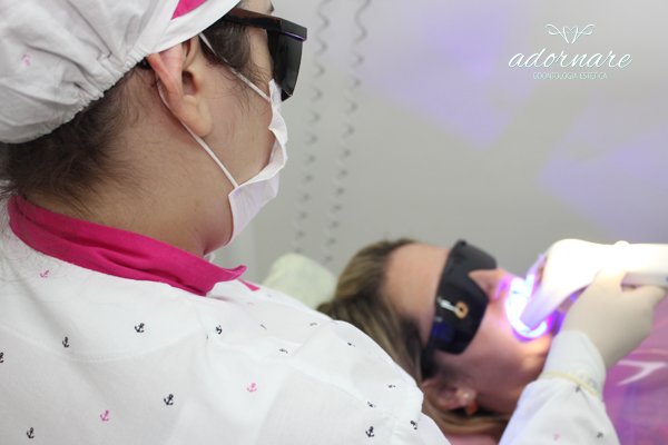 Imagem ilustrativa de clareamento dental