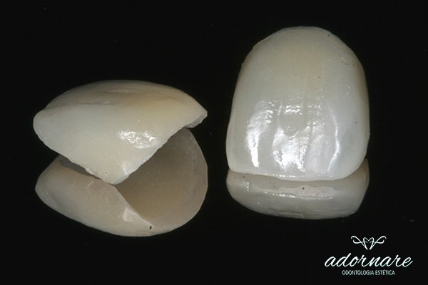 Imagem ilustrativa de lentes de contato dental