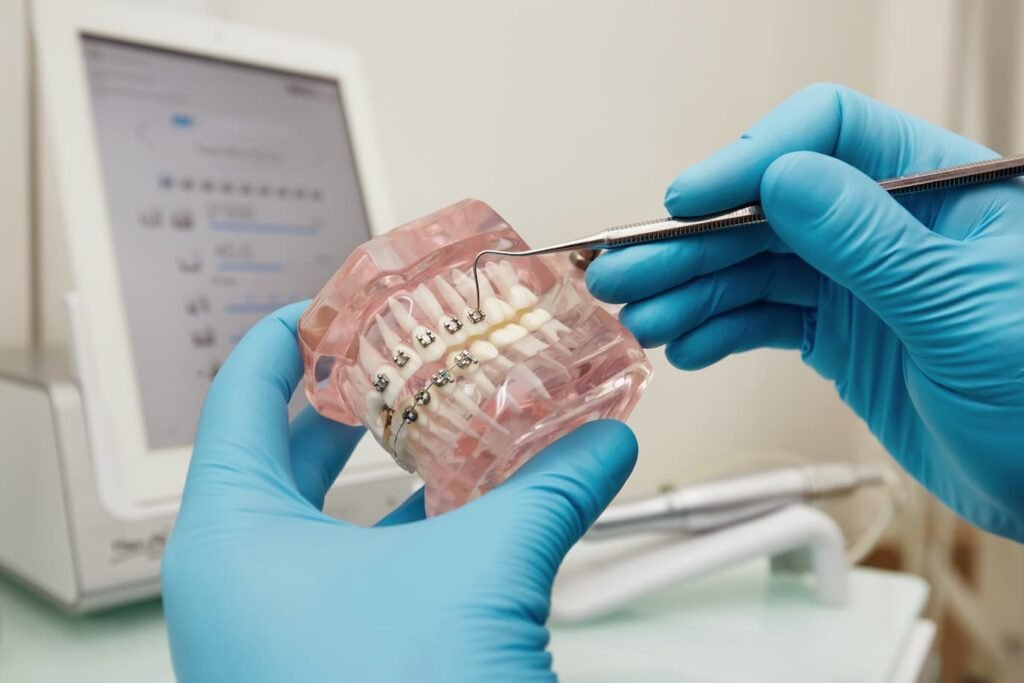Modelo odontológico com aparelho ortodôntico